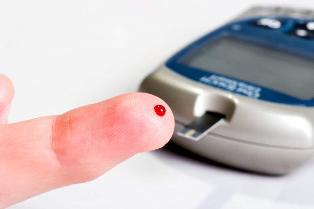 Blood Sugar Test Why and When to Do Surgicals